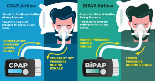 10 Step Guide To Buy Cpap/Bipap Machine In India